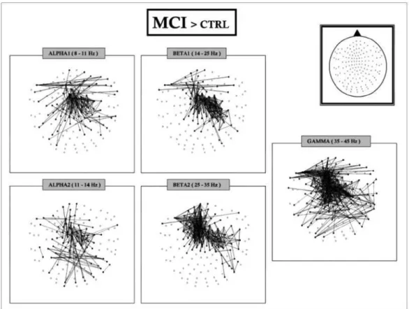 Fig. 1. Significant differences in SL between electrode pairs for different frequency bands