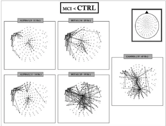 Fig. 2. Significant differences in SL between electrode pairs for different frequency bands