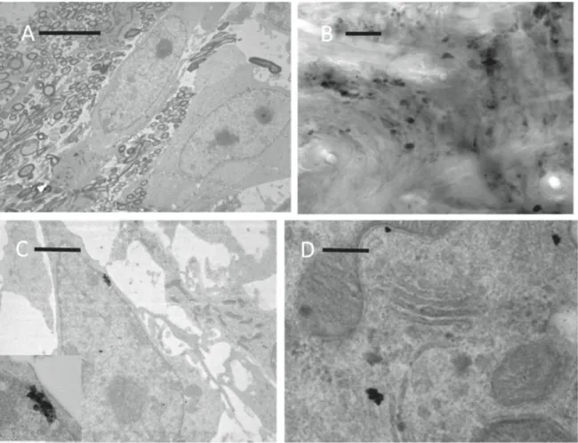 Figure 5. (A) Electron microscopic image of osmium-stained CT-2A tumor cells illustrating the ultrastructural appearance of tumor cells in 