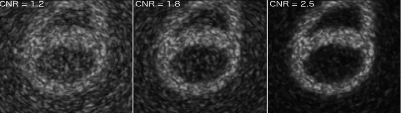 Fig. 3. Synthetic ultrasound images for the Straus dataset for different signal to noise ratio simulated by modifying the relative amplitude of tissue with respect to blood 