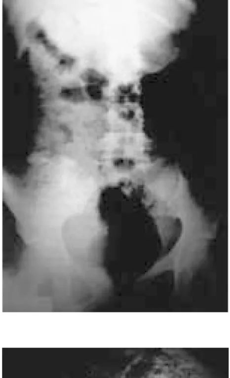 Figura 1. Radiografía