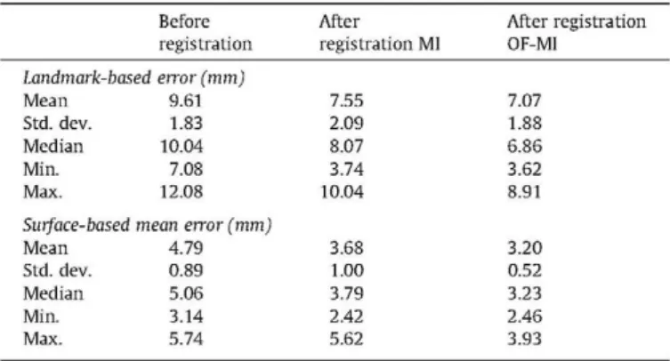 Fig. 11. Landmark-based mean error before and after registration using MI and OF-