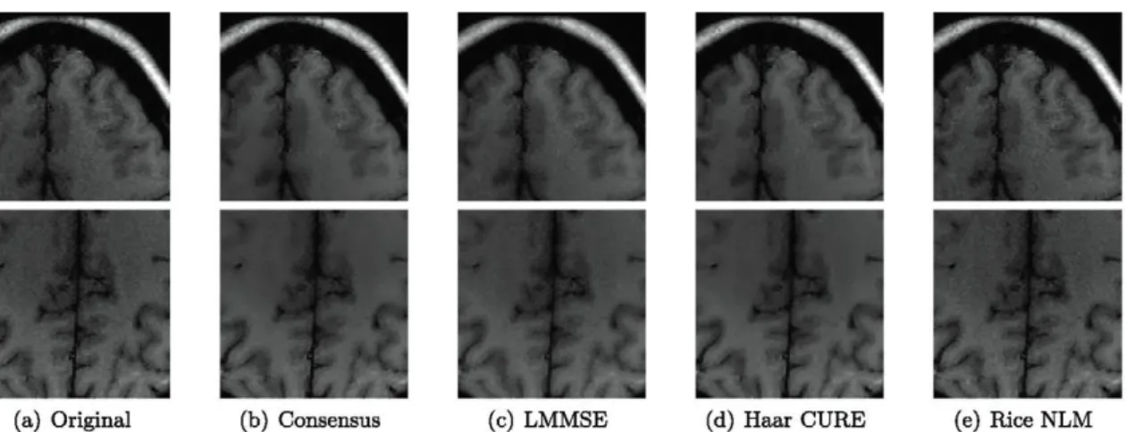 Fig. 11. Visual results for the in vivo data set in  Fig.  3(c): details from the Altered images