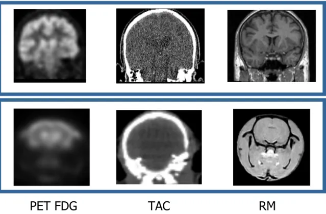 Figura 6. Comparación entre estudios en cerebro humano (fila superior) y cerebro de rata  (fila inferior) para distintas modalidades (FDG-PET, TAC y RM)