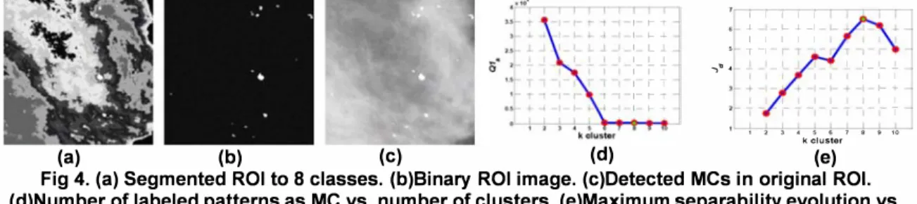 Fig  4.  (a) Segmented ROI to  8  classes.  (b)Binary  ROI image.  (c)Detected MCs in original  ROL  (d)Number of labeled patterns as MC vs