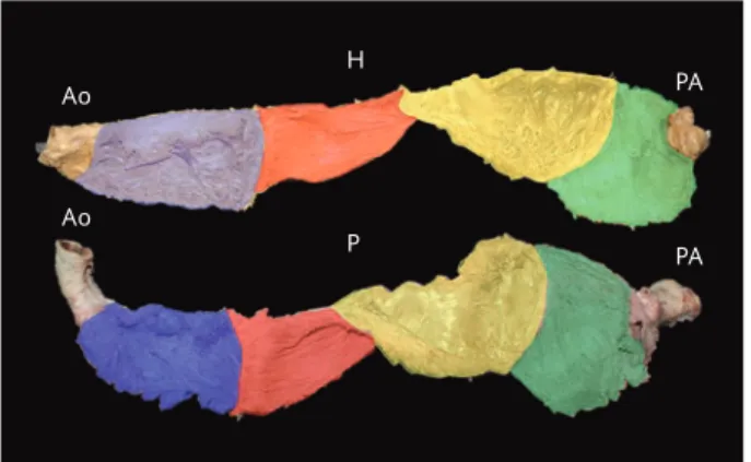 Figure 1. Unfolded ventricular muscular bands, human (H)  and porcine (P). The right and left segments of the basal  loop are in blue and red, respectively