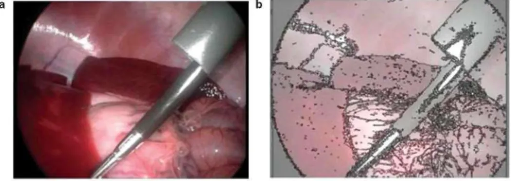 Figure 2. (a) Original image, (b) automatic segmentation results. 