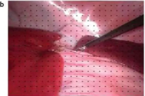 Figure 3. (a) Original frame, (b) result of distortion correction. 