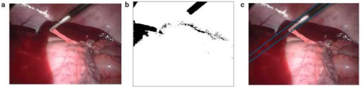 Figure 4. Process to calculate the 3D position and orientation of a surgical tool in a laparoscopic photogram: (a) Original frame, (b) result of  ROI identification and (c) detection of edges
