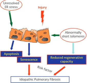 Figure 4. Alveolar epithelial cells play a critical role in the  pathogenesis of idiopathic pulmonary fibrosis