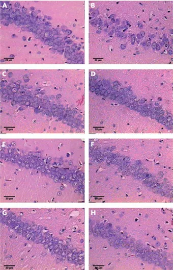 Figure 1. Representative photomicrographs of the hippo- hippo-campal CA1 area in 21-day-old rats:  A: sham; B: 