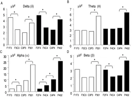 Figure 3 depicts the ascending slopes of the AAP before (Pre, black line) and during photostimulation (RPh, grey line) for delta in fronto-central and  cen-tro-parietal leads of both hemispheres, which were significant (p = 0.05).