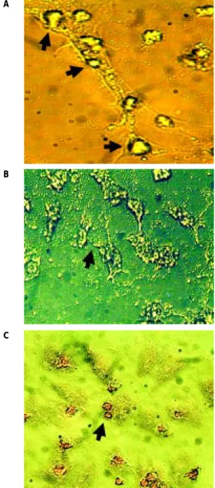 Figura 1. Micrografías que muestran las HUVEC control (sin trata-