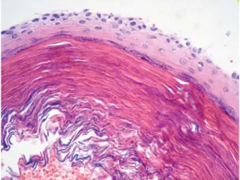Figura 5.  Ortopantomografía postoperatoria y a un año de evolución 