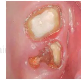 Figura 2.  Situación preoperatoria de OD 27.