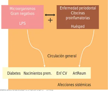 Figura 3.  Estímulos microbianos, representados principalmente por  lipopolisacáridos (LPS) y elementos infl amatorios y proinfl amatorios  (citocinas, prostanoides, proteasas) que producen daño local (pérdida  del sistema de inserción y soporte periodonta