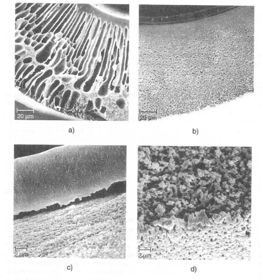 Figura 2.6. Microfotografías de secciones de fibras huecas asimétricas  