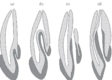 Figura 2. Aspecto clínico de la pieza afectada, indicando la flecha, el área de la invaginación.