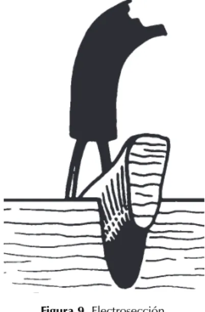 Figura 9. Electrosección.