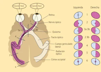 Figura 1.  Campos visuales y vías ópticas  4.  Los  números indican los lugares de las lesiones y  su correspondiente traducción en defectos del  campo visual (rojo)
