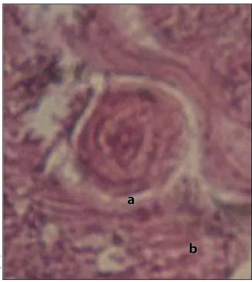 figura 4.  Miracidio esporocisto (a) penetrando el he- he-patopáncreas (b) a lo largo de la sustancia intercelular de  colágena (microscopia electrónica × 1350).