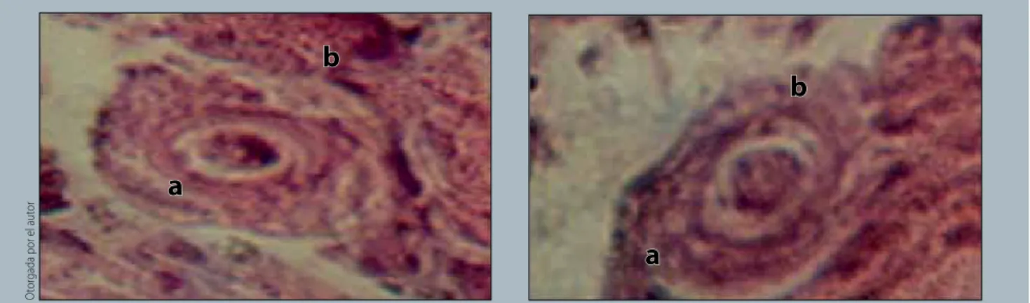 figura 7.  Esporicisto (a) de Fasciola hepatica (Linnaeus, 1758) en el tejido conjuntivo del molusco (b) L
