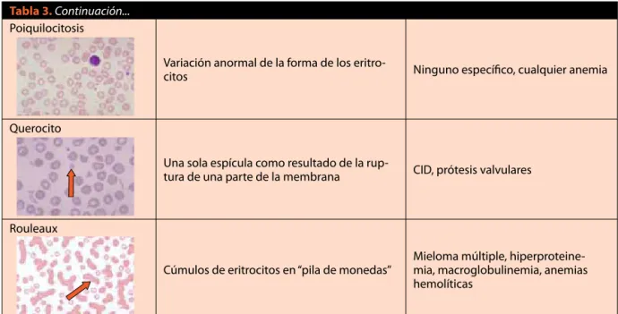 Tabla 3. Continuación...