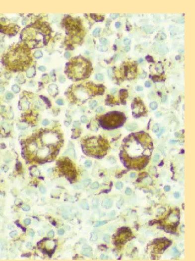 Figura 3.  Muestra de tejido de bazo con tinción de inmuno-