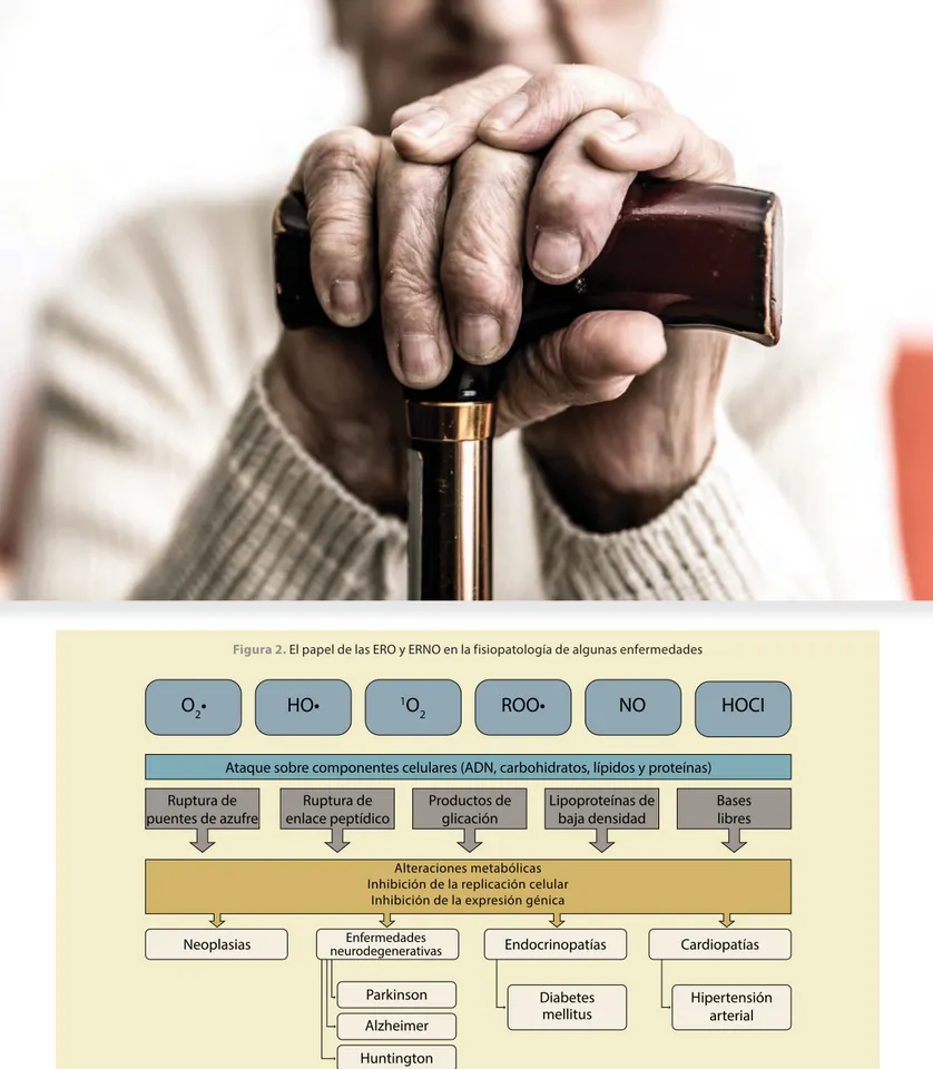 Figura 2.  El papel de las ERO y ERNO en la fisiopatología de algunas enfermedades