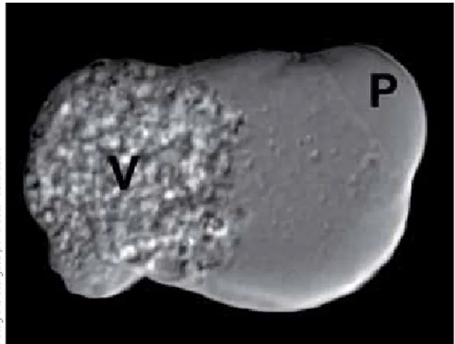 figura 2.  Trofozoíto de E. histolytica de la cepa HM-1:IMSS.  Se observa una región con diversas vesículas (V) y una  elongación llamada pseudópodo (P).