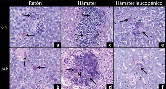 figura 5.  Aspecto microscópico de la infección hepática amibiana experimental en ratón y hámster