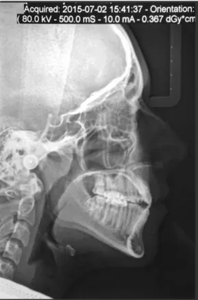 Figura 6. Telerradiografía.  