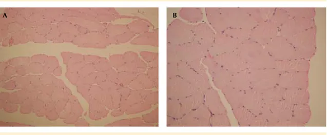 Figura 1 a y b.  Microfotografías teñidas con hematoxilina-eosina que corresponden a 100x y 200x, en las que  se observa músculo esquelético, con morfología preservada, las fibrillas con disposición adecuada, tamaño  preservado y núcleos de disposición 