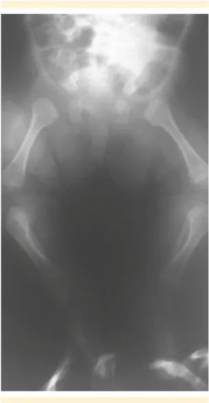Figura 6.  Huesos cortos.