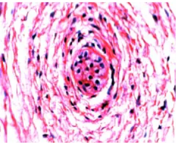 Figura 9. Tejido embrionario mucoide. Detalle del punto central del cor- cor-dón umbilical en corte transversal, en donde se observan células madre