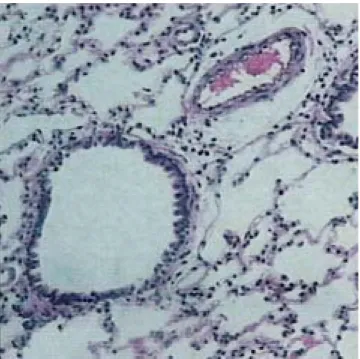 Figura 2. Fotomicrografía de un corte histológico de pulmón de rata con-
