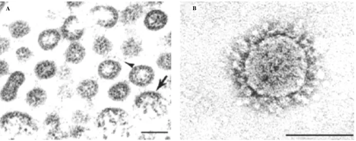 Figura 2. Características ultraestructurales del coronavirus asociado al SRAS. A. Muestras de un análisis de microscopia electrónica de nucleocáp-