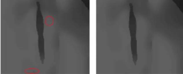 Figure 5: Anisotropic diffusion output with salt and pepper  noise and median filter output