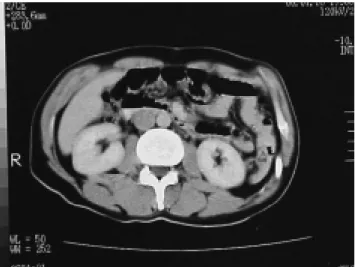 Figura 3. Modelo esquemático del “switch” duodenal.