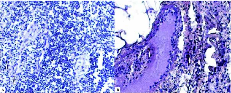 Figura 2. Fotografía A  representativa de la expresión de nNOS en tumores glómicos derechos, se observa una expresión tenue en la túnica