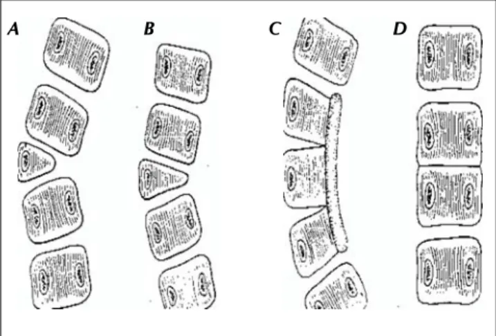 Figura 1.  A. Presencia de una hemivértebra. B. Vértebra en cuña. C y D. Tipos de falla de segmentación
