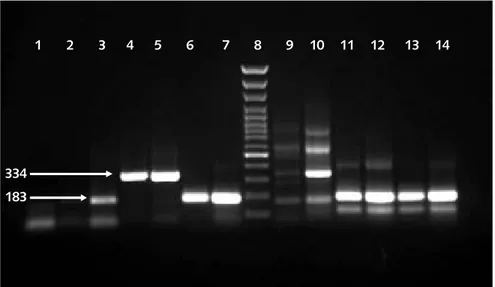 Figura 1. Detección y tipificación del VSR por RT-PCR. Electroforesis en gel de agarosa al 2%