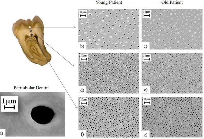 Figure 3. 2. Micrographs of the dentin microstructure. a) single tubule; b-c) Outer dentin; d-e)  Middle dentin; f-g) Inner dentin