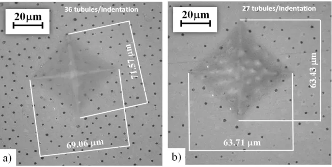 Figure  3.  7.  Indentation  of  dentin  for  determination  of  Vickers  hardness.  The  indentation  locations are within the outer dentin of a young (a) and old (b) donor tooth