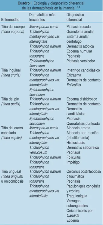 Cuadro I. Etiología y diagnóstico diferencial  de las dermatofitosis en la infancia. 1-3,9
