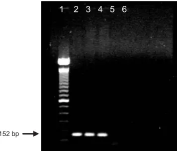 Figure 4. Agarose gel electrophoresis of PCR products obtained us-