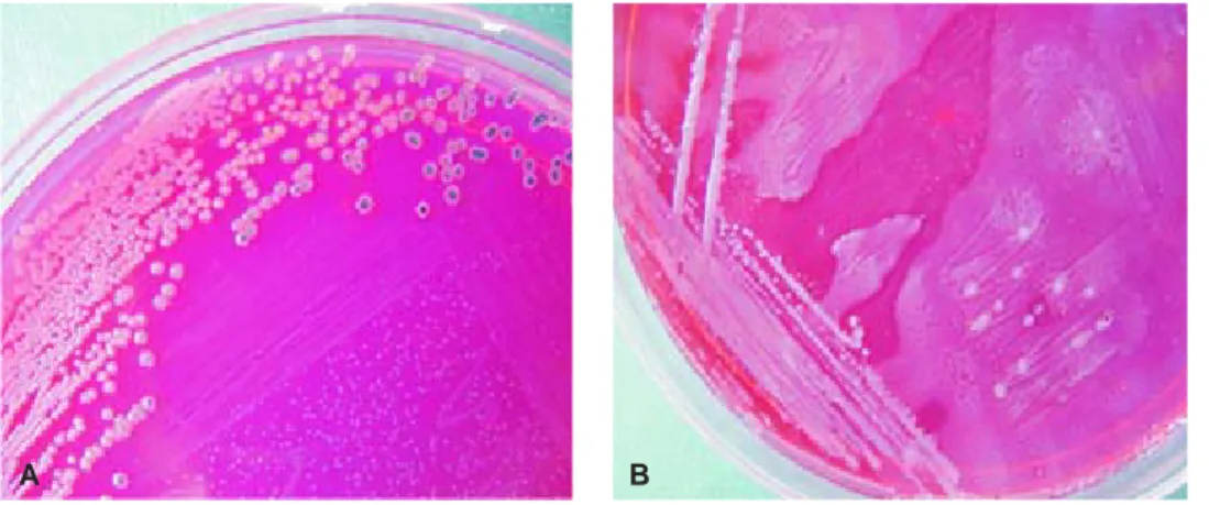 Figure 7. XLD agar plate with mixed