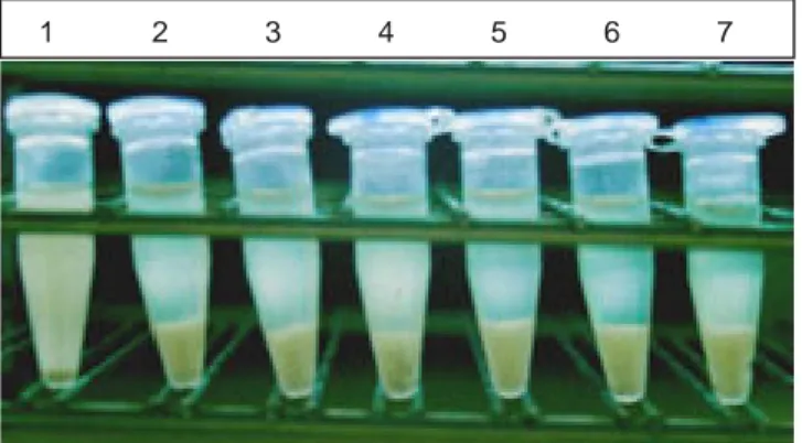 Figure 2. Agglutination test: Salmonella spp. agglutination when in con-