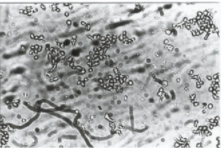 Fig. 5.  Cytotoxic effect of Staphylococcus toxins on Vero  cell monolayers at 48 hours p.i