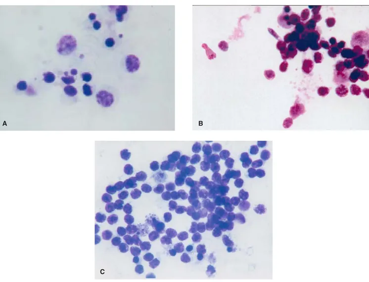 Figure 4. Microphotography of cultured human lymphocytes stimulated with A. satureioides decoction A) 0.7 mg/ml; B) 1.4 mg/ml y C) 2.8 mg/ml
